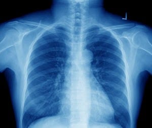 Pennsylvania failed to read xray