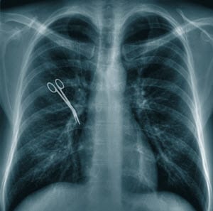 Forceps left in body