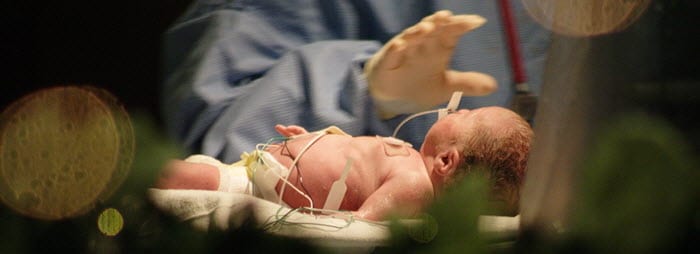 Birth Injury Lawsuit