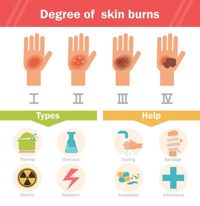 Types of burn injuries