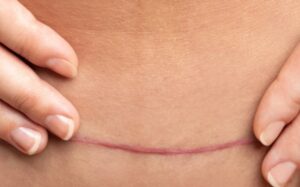 7 Warning Signs of Medical Negligence During Childbirth 2