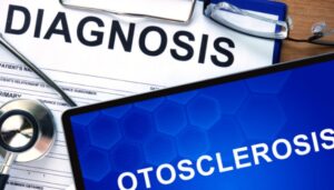 Misdiagnosis or Delayed Diagnosis