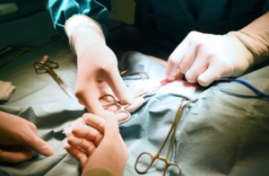 Philadelphia Surgical Mistake Lawyer
