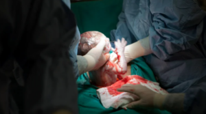 Common Labor and Delivery Mistakes That Lead to Birth Injuries 2